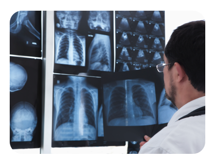 A Radiation Oncologist Looking at X-Rays of Lungs